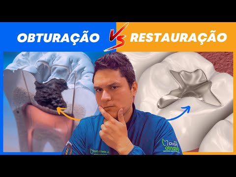 OBTURAÇÃO x RESTAURAÇÃO DENTÁRIA | QUAL A DIFERENÇA?